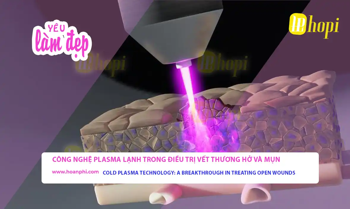 Cold Plasma Technology in Treating Open Wounds and Acne